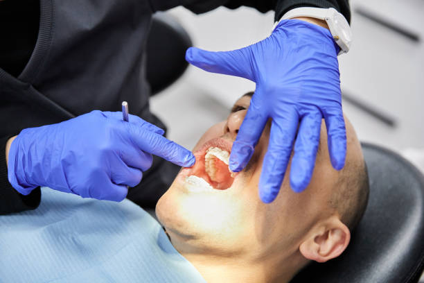 Best Same-Day Emergency Dental Services in Calvert, TX